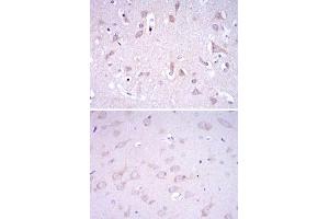 Immunohistochemical analysis of paraffin-embedded human brain tissues (upper) and rat brain tissues (bottom) using GRIA3 monoclonal antibody, clone 1D2  with DAB staining.