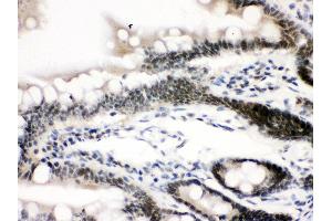 Anti-CTCF Picoband antibody, IHC(P) IHC(P): Rat Intestine Tissue