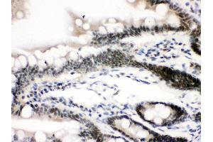 Anti-CTCF Picoband antibody, IHC(P) IHC(P): Rat Intestine Tissue (CTCF anticorps  (AA 521-727))