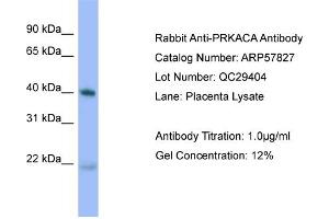 WB Suggested Anti-PRKACA  Antibody Titration: 0. (PRKACA anticorps  (N-Term))