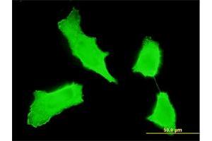 Immunofluorescence of monoclonal antibody to ERBB2 on HeLa cell. (ErbB2/Her2 anticorps  (AA 22-121))