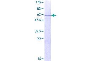 Image no. 1 for Homeobox B13 (HOXB13) (AA 1-284) protein (GST tag) (ABIN1306947)