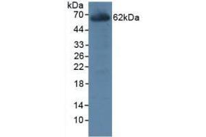 Detection of CES1 in Rat Liver Tissue using Polyclonal Antibody to Carboxylesterase 1 (CES1) (CES1 anticorps  (AA 19-300))