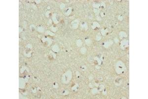 Immunohistochemistry of paraffin-embedded human brain tissue using ABIN7167840 at dilution of 1:100 (RDH12 anticorps  (AA 182-316))