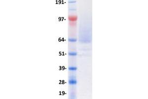 Validation with Western Blot