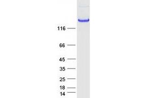 Validation with Western Blot