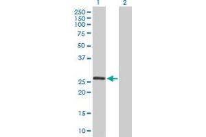 Western Blot analysis of MRPL10 expression in transfected 293T cell line by MRPL10 MaxPab polyclonal antibody.