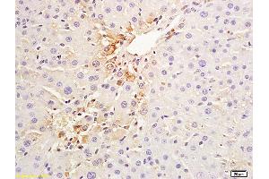 Formalin-fixed and paraffin embedded pig liver labeled with Anti-CK18 Polyclonal Antibody, Cy3 Conjugated (ABIN676973) at 1:200 for 60 minutes at 37C. (Cytokeratin 18 anticorps  (AA 53-150))