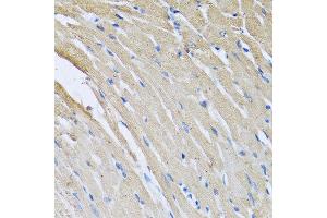 Immunohistochemistry of paraffin-embedded rat heart using CRHBP antibody at dilution of 1:100 (40x lens). (CRHBP anticorps)
