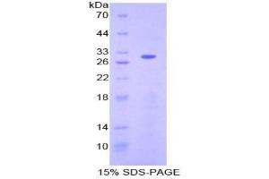 SDS-PAGE analysis of Human ATF6 Protein.