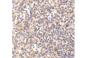 Immunohistochemical staining ofDNaseII in human spleen with DNase II antibody at 5μg/ml. (DNASE2 anticorps)
