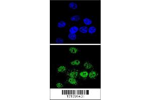 Confocal immunofluorescent analysis of MEF2A Antibody with Hela cell followed by Alexa Fluor 488-conjugated goat anti-rabbit lgG (green).