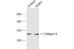 Lane 1: Mouse Embryo lysates Lane 2: MG63 lysates probed with COL2A1 Polyclonal Antibody, Unconjugated  at 1:300 dilution and 4˚C overnight incubation. (COL2A1 anticorps  (AA 231-330))