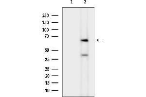 anti-Cerebellar Degeneration-Related Protein 1, 34kDa (CDR1) (N-Term) antibody