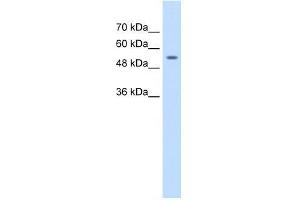 Human Jurkat; WB Suggested Anti-ZNF498 Antibody Titration: 1. (Zinc Finger and SCAN Domain Containing 25 (ZSCAN25) (Middle Region) anticorps)