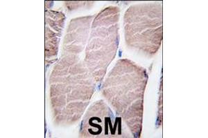 Formalin-fixed and paraffin-embedded human skeletal muscle tissue reacted with PYGM antibody , which was peroxidase-conjugated to the secondary antibody, followed by DAB staining.