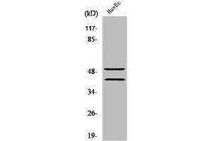 Western Blot analysis of Jurkat cells using TCF-1 Polyclonal Antibody (TCF7 anticorps  (N-Term))
