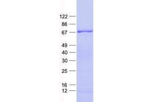 Validation with Western Blot