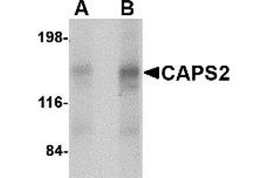Western Blotting (WB) image for anti-Calcyphosine 2 (CAPS2) (Middle Region) antibody (ABIN1030895) (Calcyphosine 2 anticorps  (Middle Region))