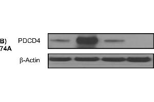 Western blotting analysis demonstrating over-expression or knock-down of PDCD4 using PDCD4 plasmid or PDCD4 targeted siRNA, respectively, versus control plasmids (PCMV6, siRNA ctrl) in the UT-SCC cell lines (A) 24A, (B) 74A, and (C) 87.