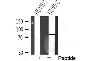 Western blot analysis of FSHR expression in HUVEC cell extracts (FSHR anticorps  (Internal Region))