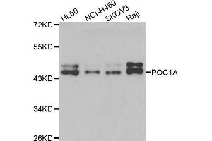 Western blot analysis of extracts of various cell lines, using POC1A antibody (ABIN5975553) at 1/1000 dilution. (POC1A anticorps)
