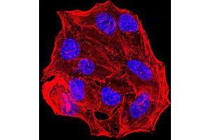 Immunofluorescence analysis of Hela cells using ESR1 mouse mAb. (Estrogen Receptor alpha anticorps  (AA 2-185))