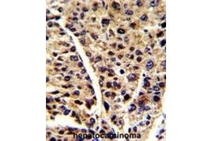 Immunohistochemistry (IHC) image for anti-Enolase 3 (Beta, Muscle) (ENO3) antibody (ABIN3001691) (ENO3 anticorps)