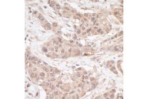 Immunohistochemistry (IHC) image for anti-Four and A Half LIM Domains 2 (FHL2) (C-Term) antibody (ABIN7453598) (FHL2 anticorps  (C-Term))