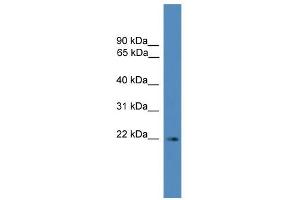 WB Suggested Anti-SSX3 Antibody Titration: 0. (SSX3 anticorps  (N-Term))