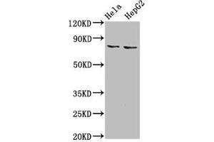 Western Blot Positive WB detected in: Hela whole cell lysate, HepG2 whole cell lysate All lanes: ESRP2 antibody at 6 μg/mL Secondary Goat polyclonal to rabbit IgG at 1/50000 dilution Predicted band size: 79, 78 kDa Observed band size: 79 kDa (ESRP2 anticorps  (AA 615-720))