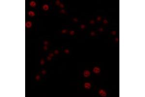 ABIN6266706 staining COLO205 by IF/ICC. (T-Box 1 anticorps  (C-Term))