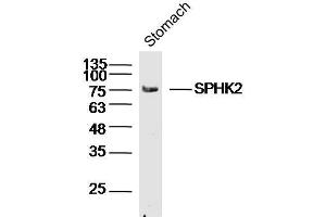 Mouse stomach lysates probed with SPHK2 Polyclonal Antibody, unconjugated  at 1:300 overnight at 4°C followed by a conjugated secondary antibody for 60 minutes at 37°C. (SPHK2 anticorps  (AA 101-200))