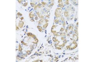 Immunohistochemistry of paraffin-embedded human stomach using PRK antibody (ABIN6132517, ABIN6146187, ABIN6146188 and ABIN6223135) at dilution of 1:100 (40x lens). (PRKAG1 anticorps  (AA 1-331))