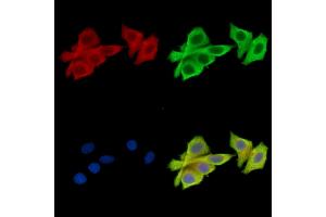 ABIN7096864 and ABIN7100930 staining HepG2 cells by IF/ICC. (NAA25 anticorps)