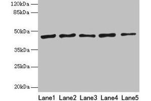 Western blot All lanes: RRM2 antibody at 8 μg/mL Lane 1: HepG2 whole cell lysate Lane 2: Jurkat whole cell lysate Lane 3: Hela whole cell lysate Lane 4: K562 whole cell lysate Lane 5: 293T whole cell lysate Secondary Goat polyclonal to rabbit IgG at 1/10000 dilution Predicted band size: 45, 52 kDa Observed band size: 45 kDa (RRM2 anticorps  (AA 1-389))