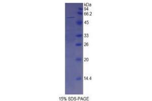 SDS-PAGE analysis of Human Spondin 2 Protein.
