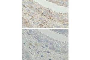 IHC analysis of FFPE human prostate tissue. (Endoplasmic Reticulum Amyloid Binding Protein (ERAB) (AA 199-235) anticorps)