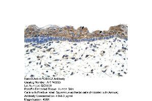 Rabbit Anti-APOBEC2 Antibody  Paraffin Embedded Tissue: Human Skin Cellular Data: Squamous epithelial cells Antibody Concentration: 4. (APOBEC2 anticorps  (N-Term))