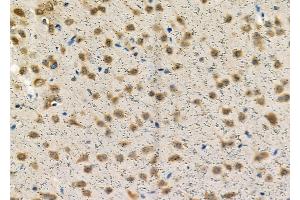 ABIN6257543 and ABIN6274338 at 1/100 staining Rat brain tissue by IHC-P. (TCOF1 anticorps  (N-Term))