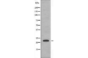 Western blot analysis of extracts from HeLa cells using CBF β antibody. (CBFB anticorps  (N-Term))