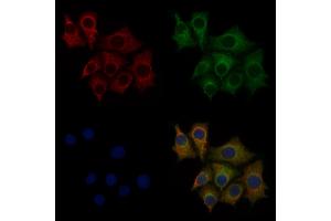 ABIN6260181 and ABIN6277800 staining HepG2 cells by IF/ICC. (BACE1 anticorps  (C-Term))