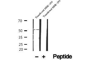 Western blot analysis of extracts of human placenta tissue, using SRPX2 antibody.