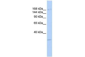 WB Suggested Anti-UTX Antibody Titration: 0. (KDM6A anticorps  (Middle Region))