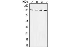 Western blot analysis of CD61 expression in HeLa (A), Raw264. (Integrin beta 3 anticorps  (C-Term))