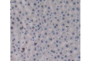 IHC-P analysis of Kidney tissue, with DAB staining. (PTPRJ anticorps  (AA 1033-1277))