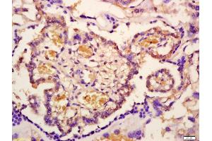 Formalin-fixed and paraffin embedded mouse placenta labeled with Anti-Phospho-IRAK1(Thr209) Polyclonal Antibody, Unconjugated (ABIN1385694) at 1:200 followed by conjugation to the secondary antibody and DAB staining