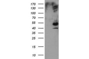 Image no. 1 for anti-DIX Domain Containing 1 (DIXDC1) antibody (ABIN1497840) (DIXDC1 anticorps)
