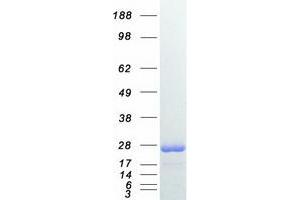 Validation with Western Blot