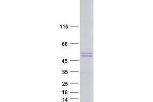 Validation with Western Blot